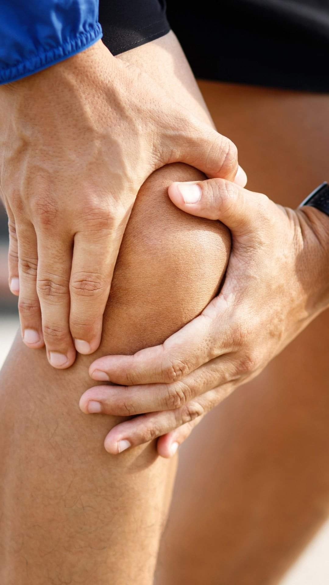 Understanding and Overcoming Runner's Knee: A Physiotherapy Perspective