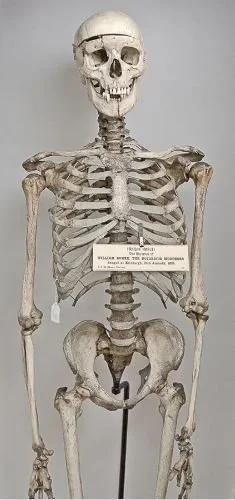 Squelette de William Burke 1829