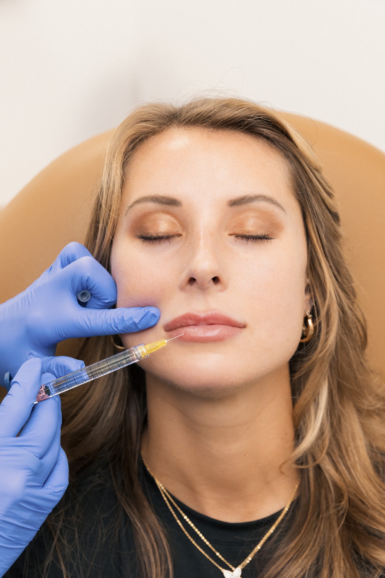 Lolia Aesthetics - Lip Filler-1472.jpg