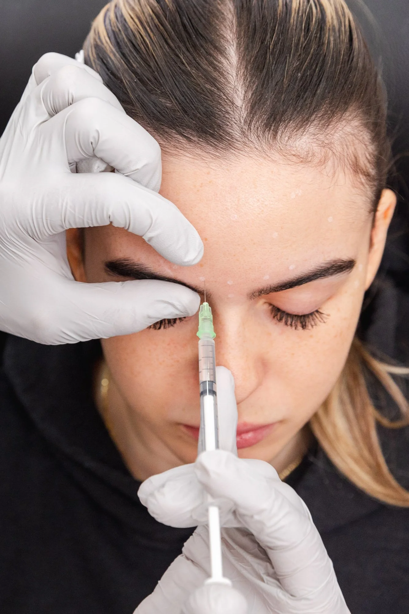 Salas Plastic Surgery - Botox-1594.jpg