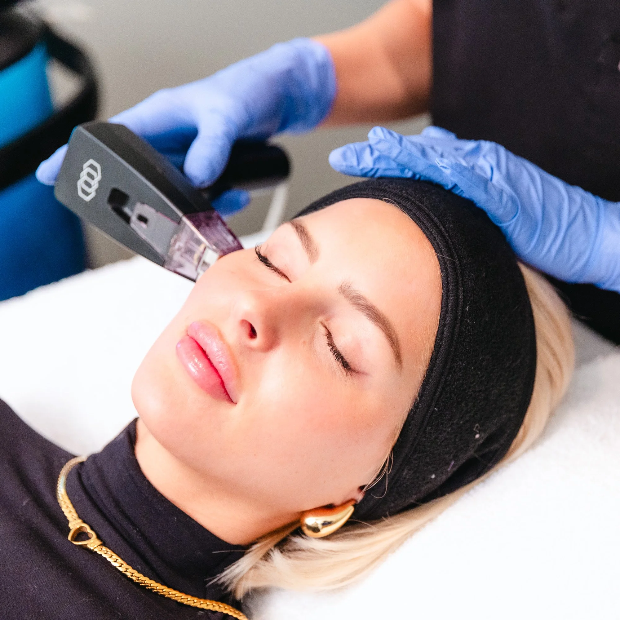 DELOZIER-MICRONEEDLE-1615.jpg