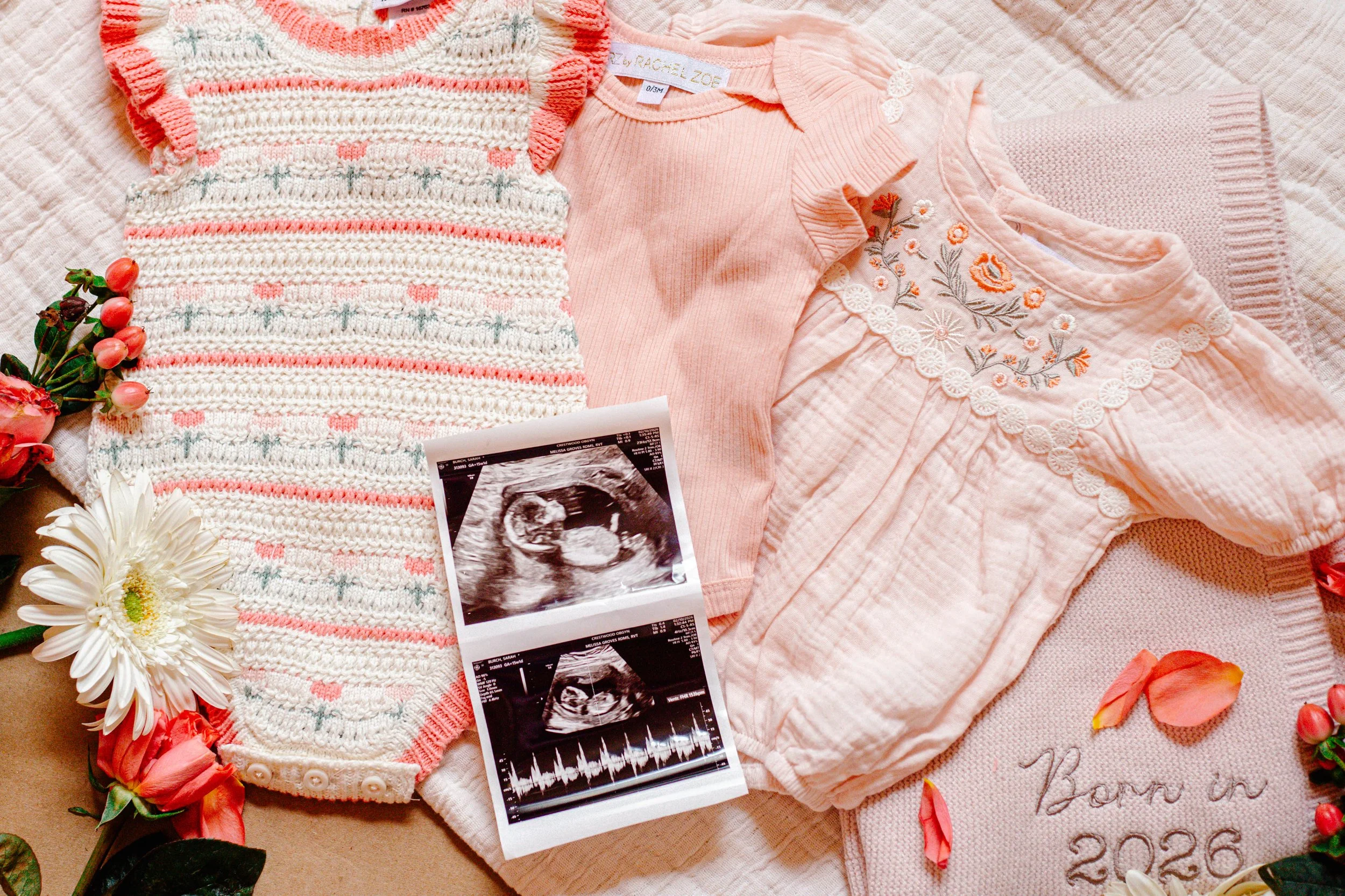 Baby clothes, an ultrasound image, and flowers arranged on a soft surface for a gender reveal or baby announcement.