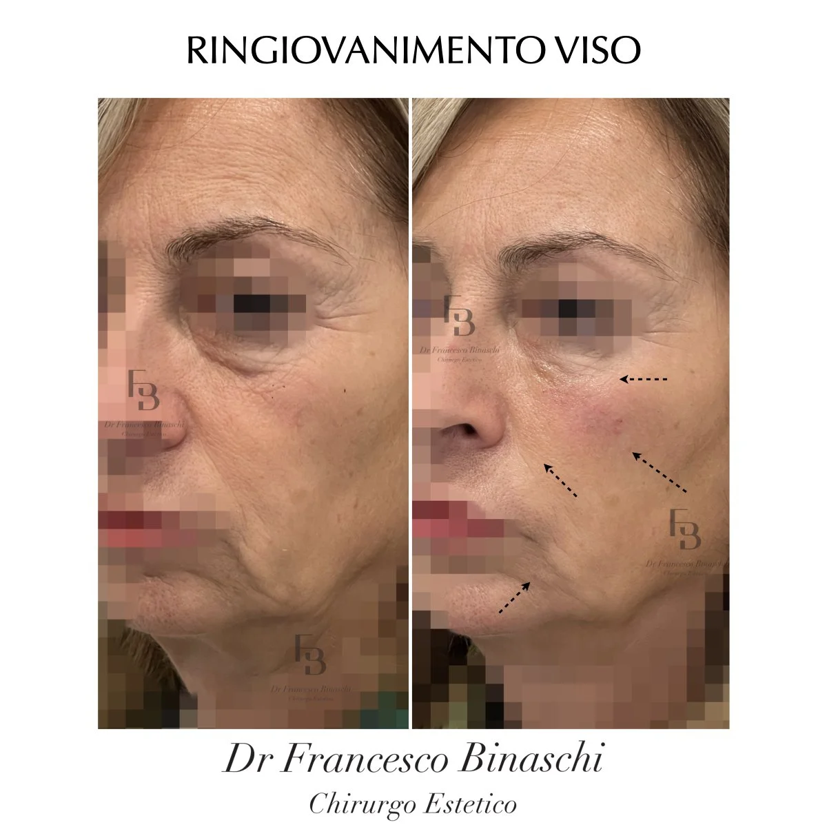 Services 1 — Dr Francesco Binaschi Medicina e Chirurgia Estetica