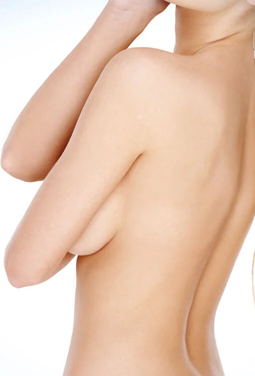 0000000306-arm-lift.jpg