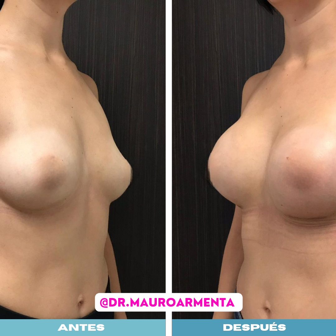 Simple Photo Before and After Skincare Instagram Post_20240611_133146_0000.png