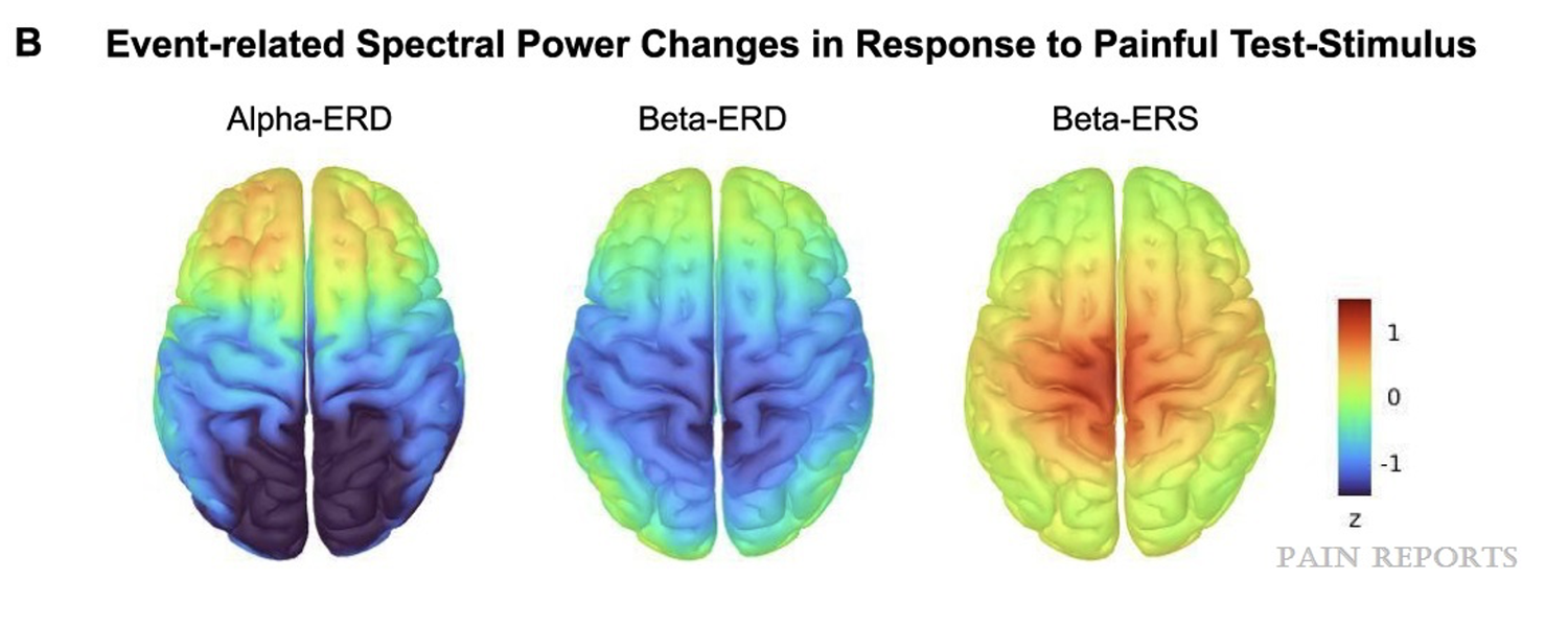 Brain and pain: a two-way street. — Baillet Lab [ neuroSPEED ]