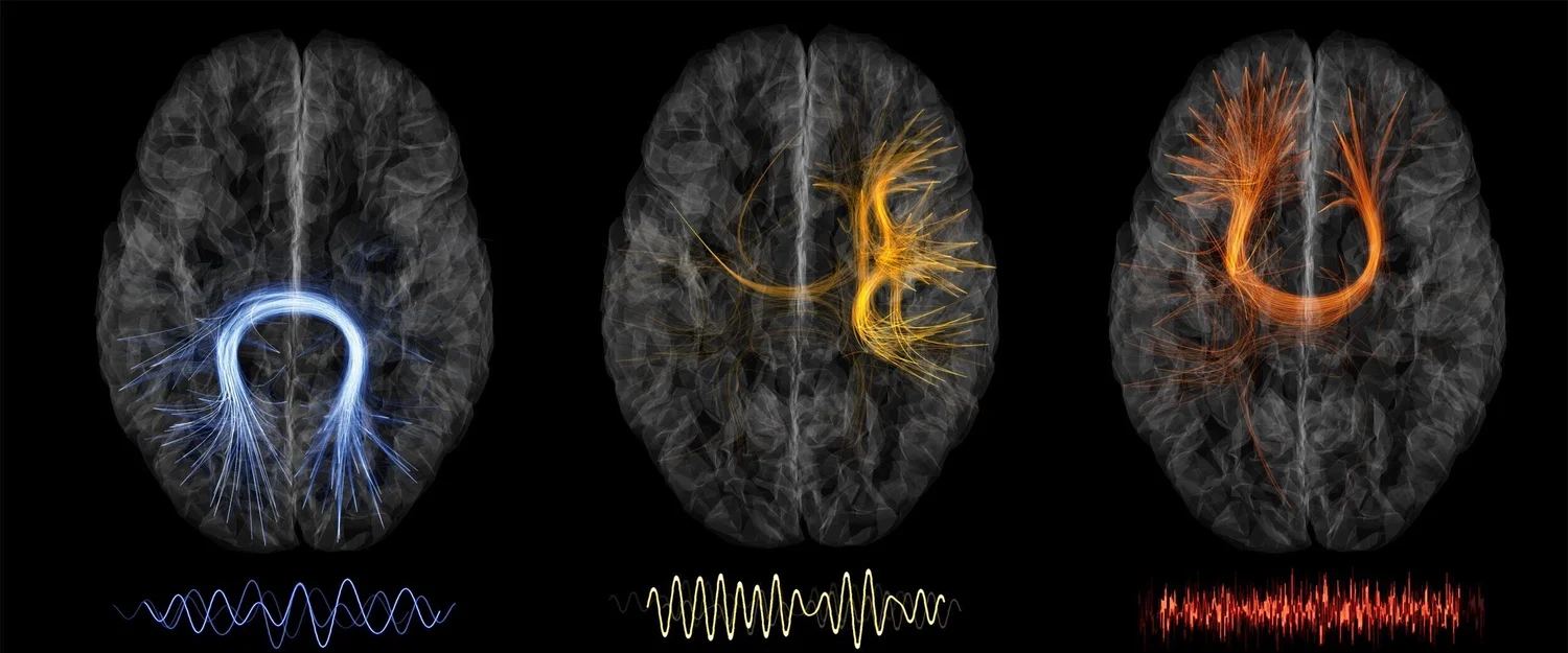 Baillet Lab [ neuroSPEED ]