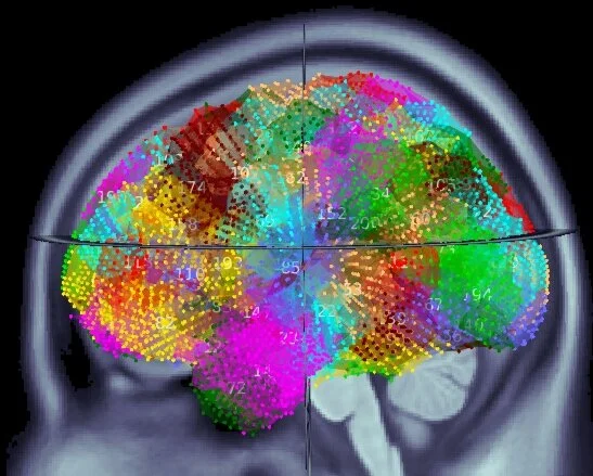 News — Baillet Lab [ neuroSPEED ]