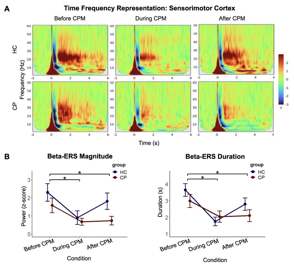 Brain and pain: a two-way street. — Baillet Lab [ neuroSPEED ]
