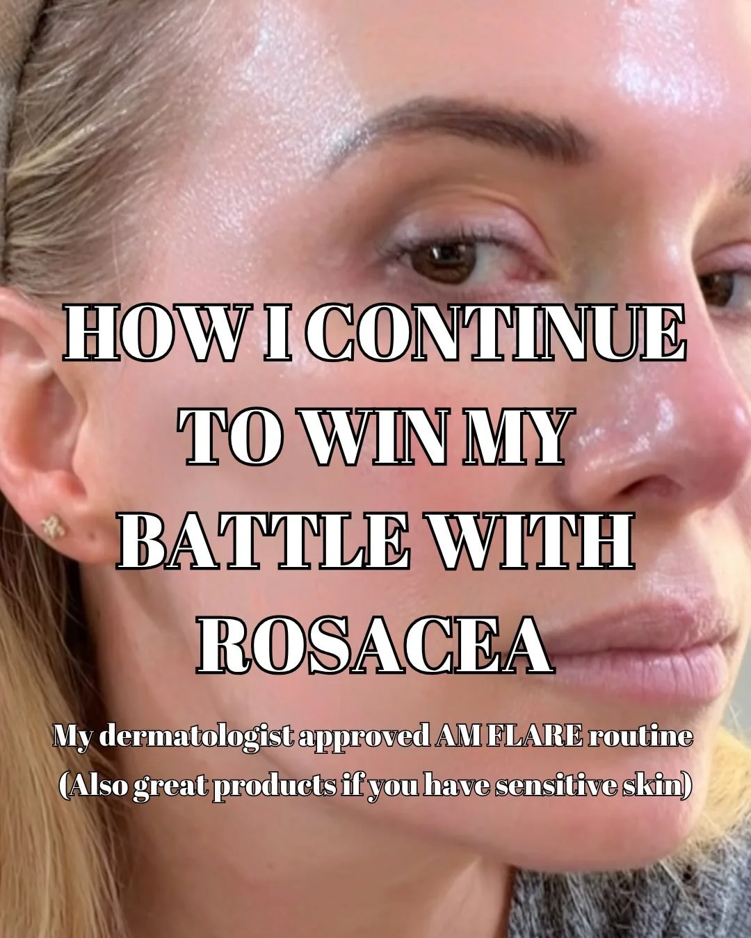 Mention YES PLEASE below and I&rsquo;ll DM you the details!! If you don&rsquo;t get a DM promptly, you can always use the link in my profile to shop.

Swipe through to see them all! Win your battle with Rosacea!!! My dermatologist approved AM FLARE r