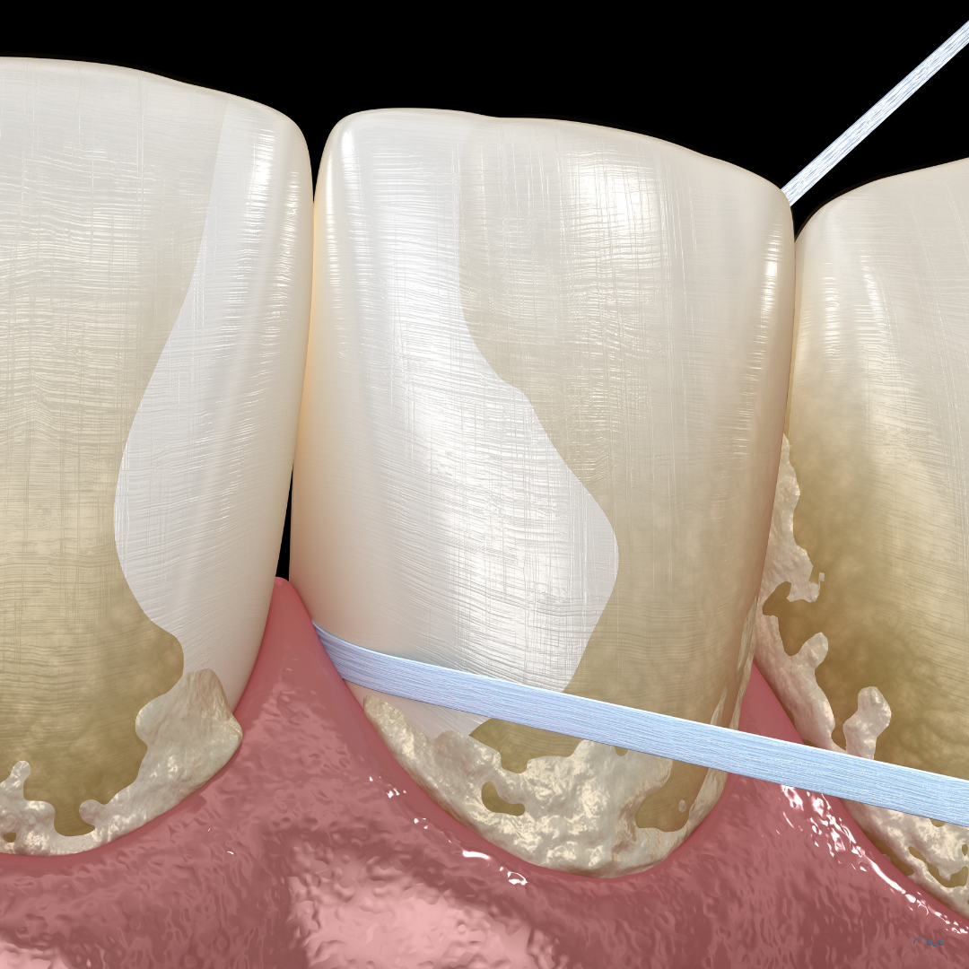 Floss or interdental brushes: which should you actually be using?