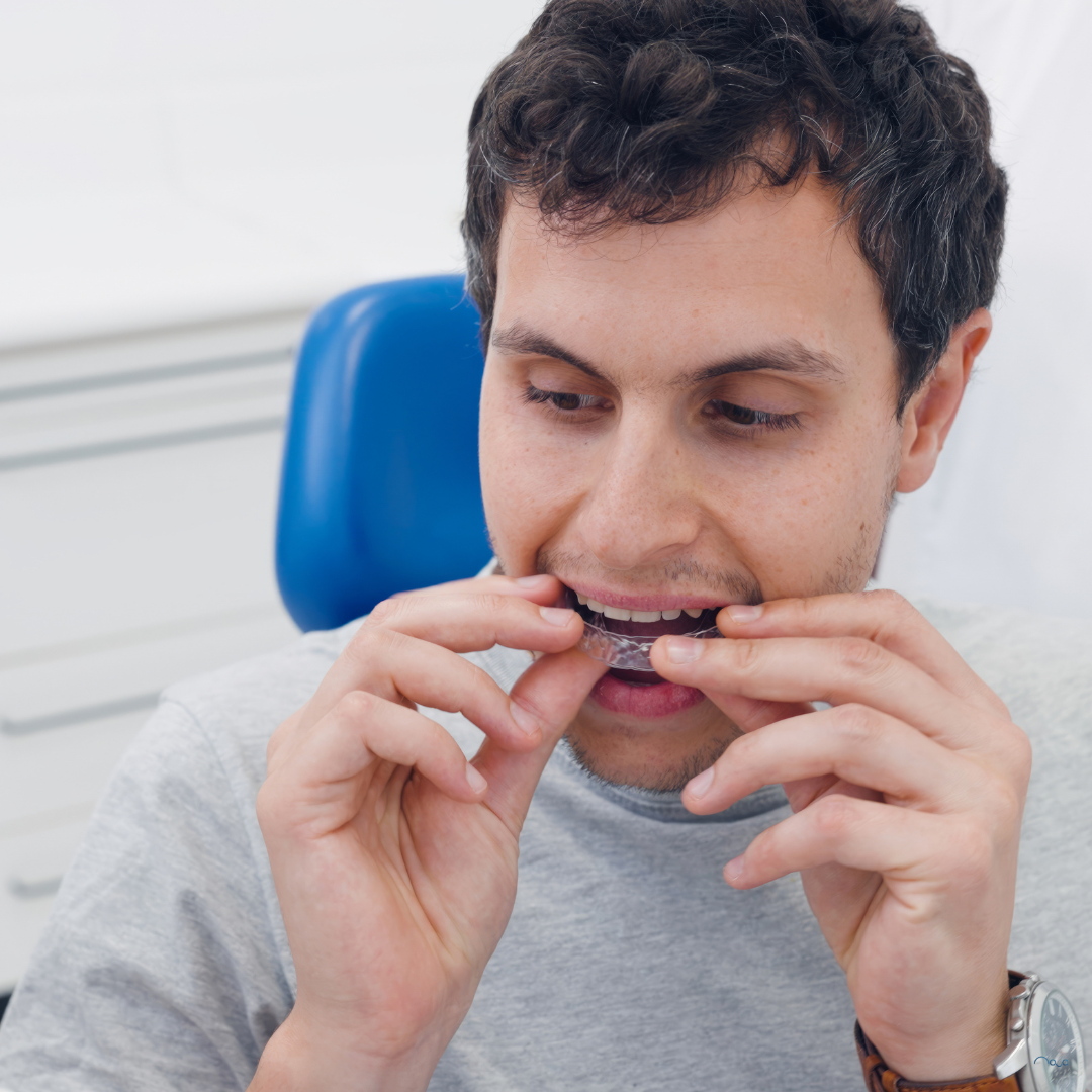 Do I Need Invisalign? How To Know If It’s Actually Right For You