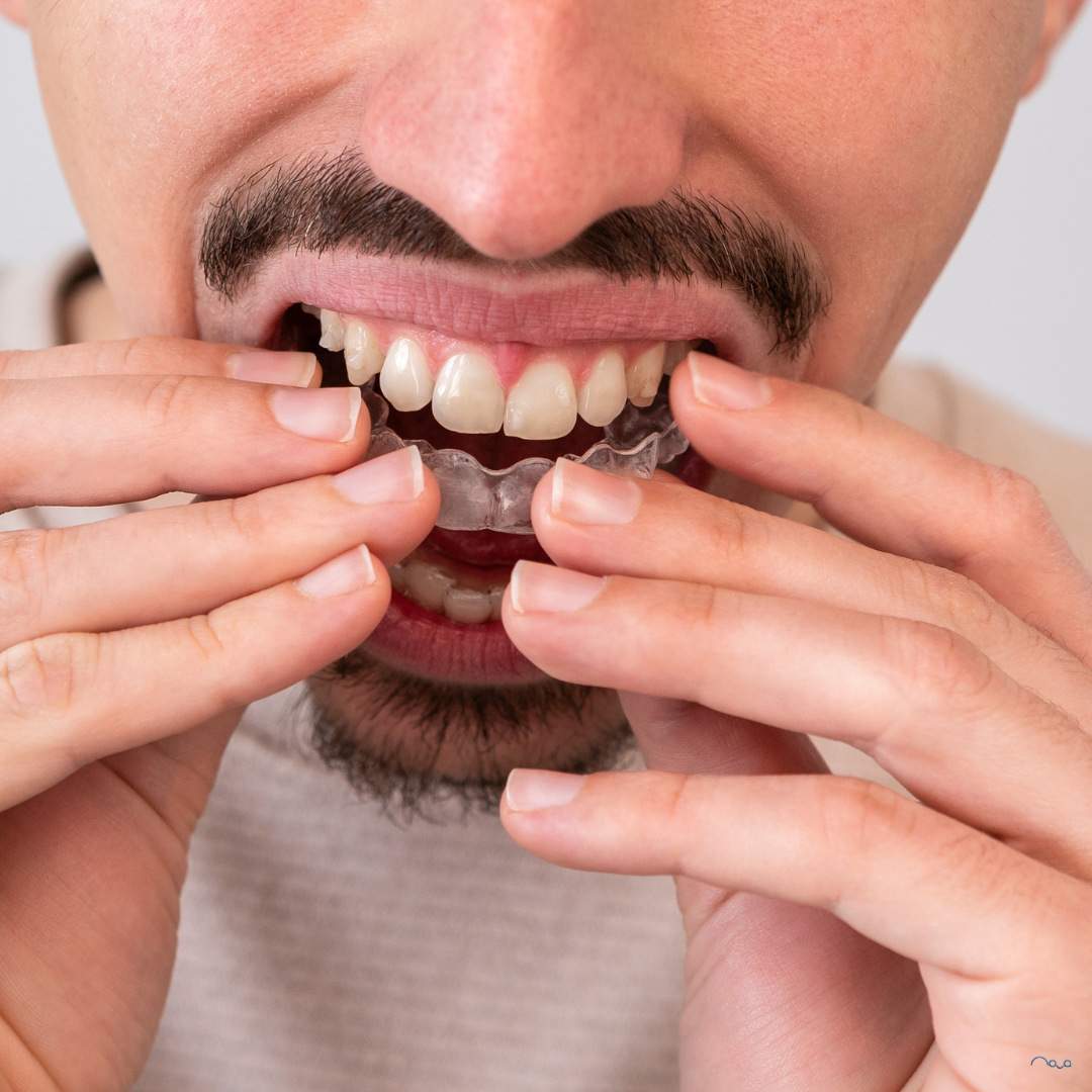 How to Save Money on Invisalign (UK Guide to Lower Costs Without Cutting Corners)