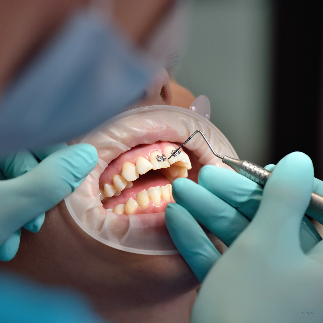 What Counts as a Dental Emergency?