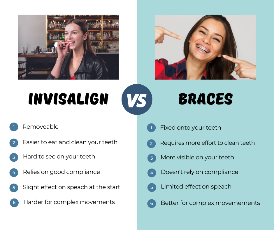 Is Invisalign Better Than Braces?, Dental Salon