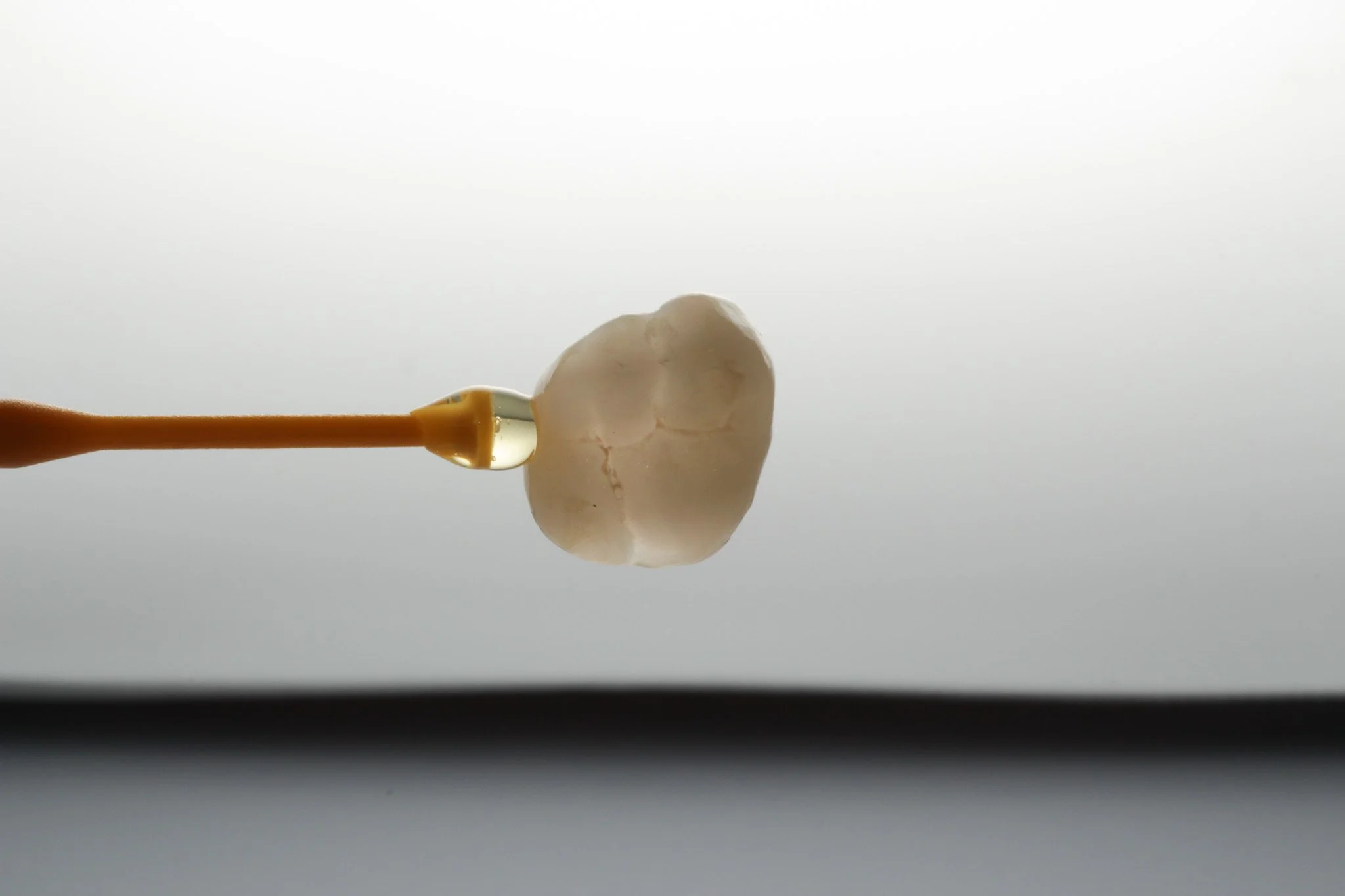 How To Look After Your Dental Onlay 