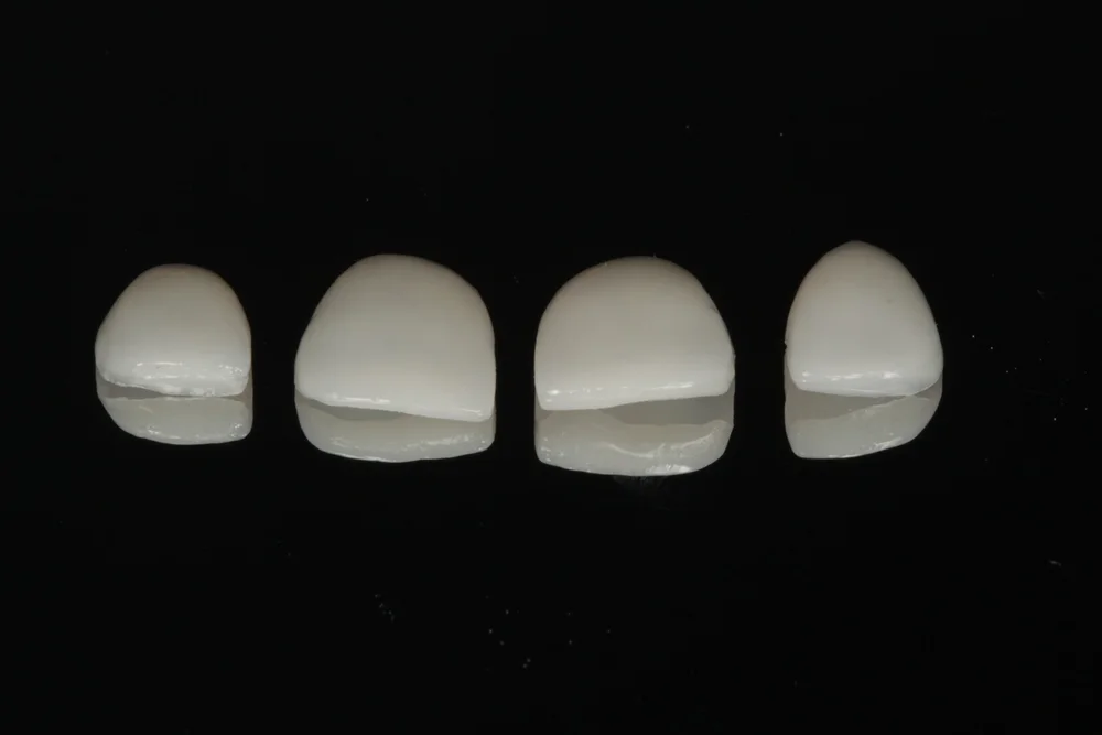 How much do Veneers cost in the UK — Nova Smiles