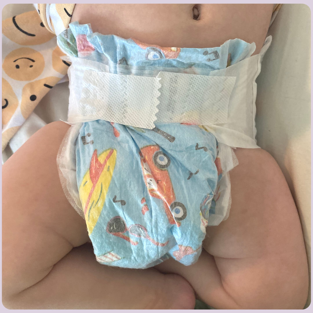 kfp registry guide Karing for Postpartum