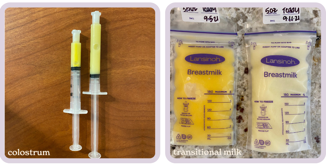 All About Colostrum | Karing for Postpartum