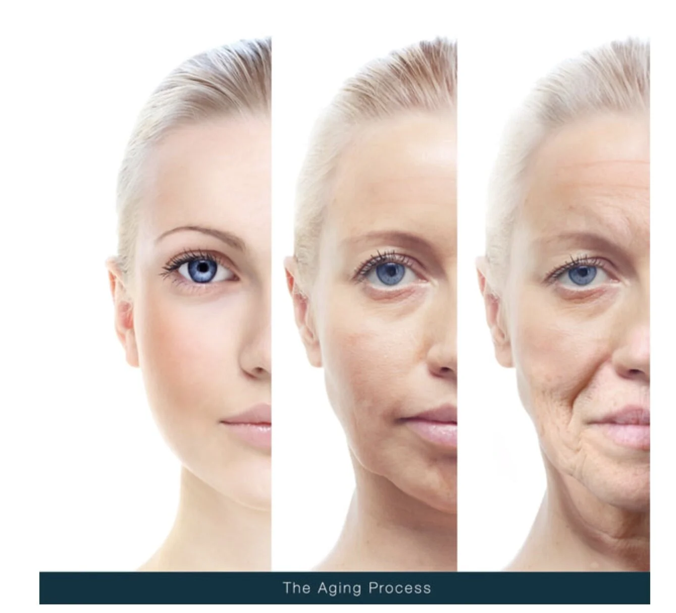 The Reason Behind Sagging Skin.