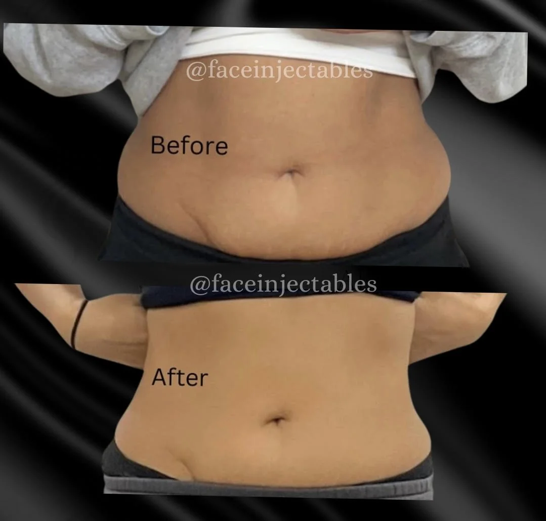 stomach fat.jpg