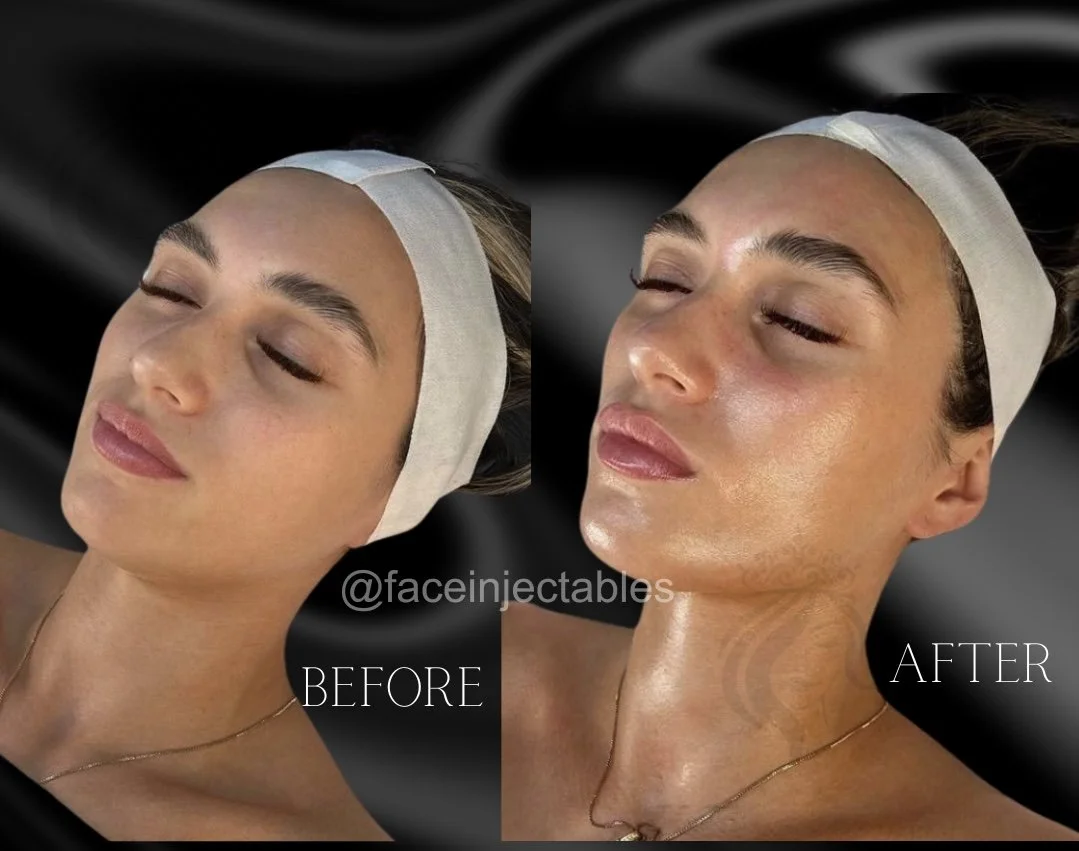 best glow facial .jpg
