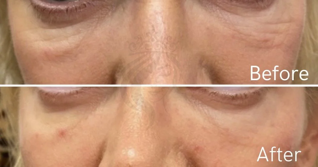 before after pictures.jpg