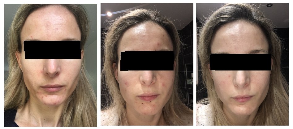 Evolution Caroline.jpg