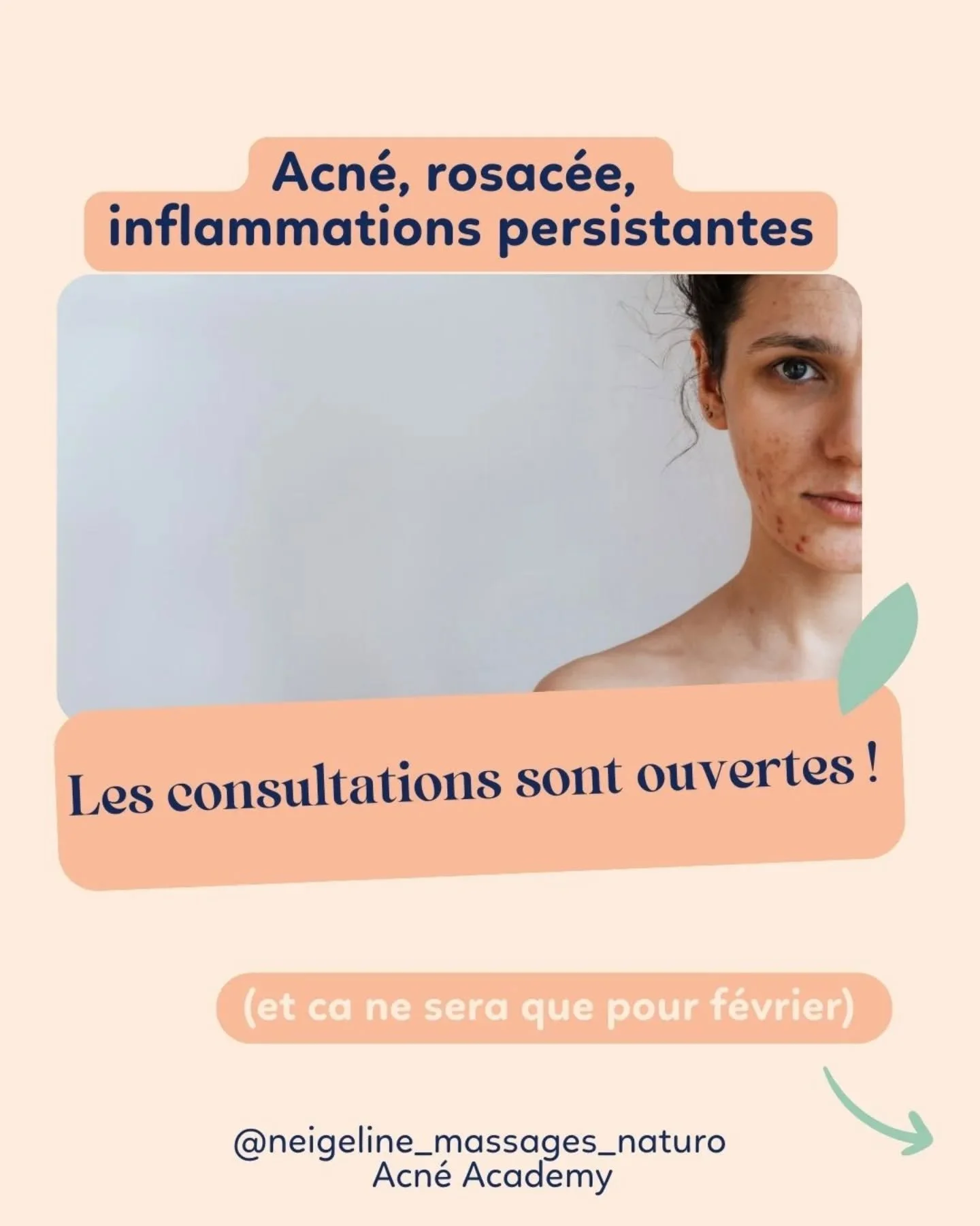 Acn&eacute; persistante, rosac&eacute;e, inflammations, inconfort&hellip;

Et cette impression d&rsquo;avoir d&eacute;j&agrave; &laquo; tout essay&eacute; &raquo;.

Habituellement, j&rsquo;accompagne ces probl&eacute;matiques uniquement dans le cadre