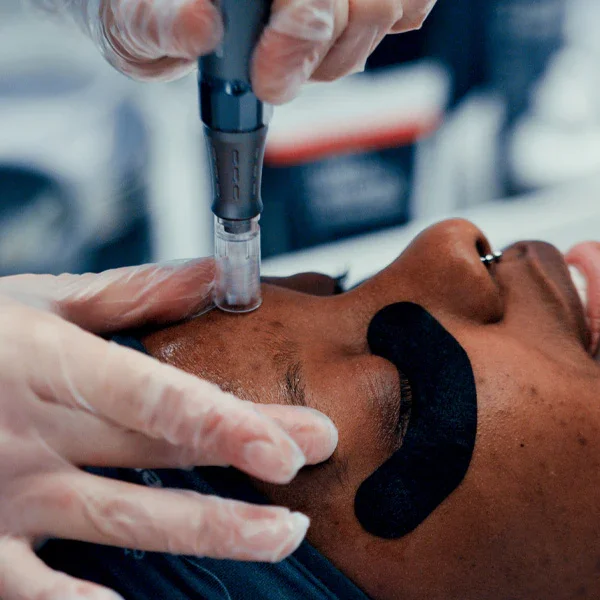 A person receiving a cosmetic facial treatment, with a practitioner using a handheld device on their face, wearing gloves and a black eye patch.