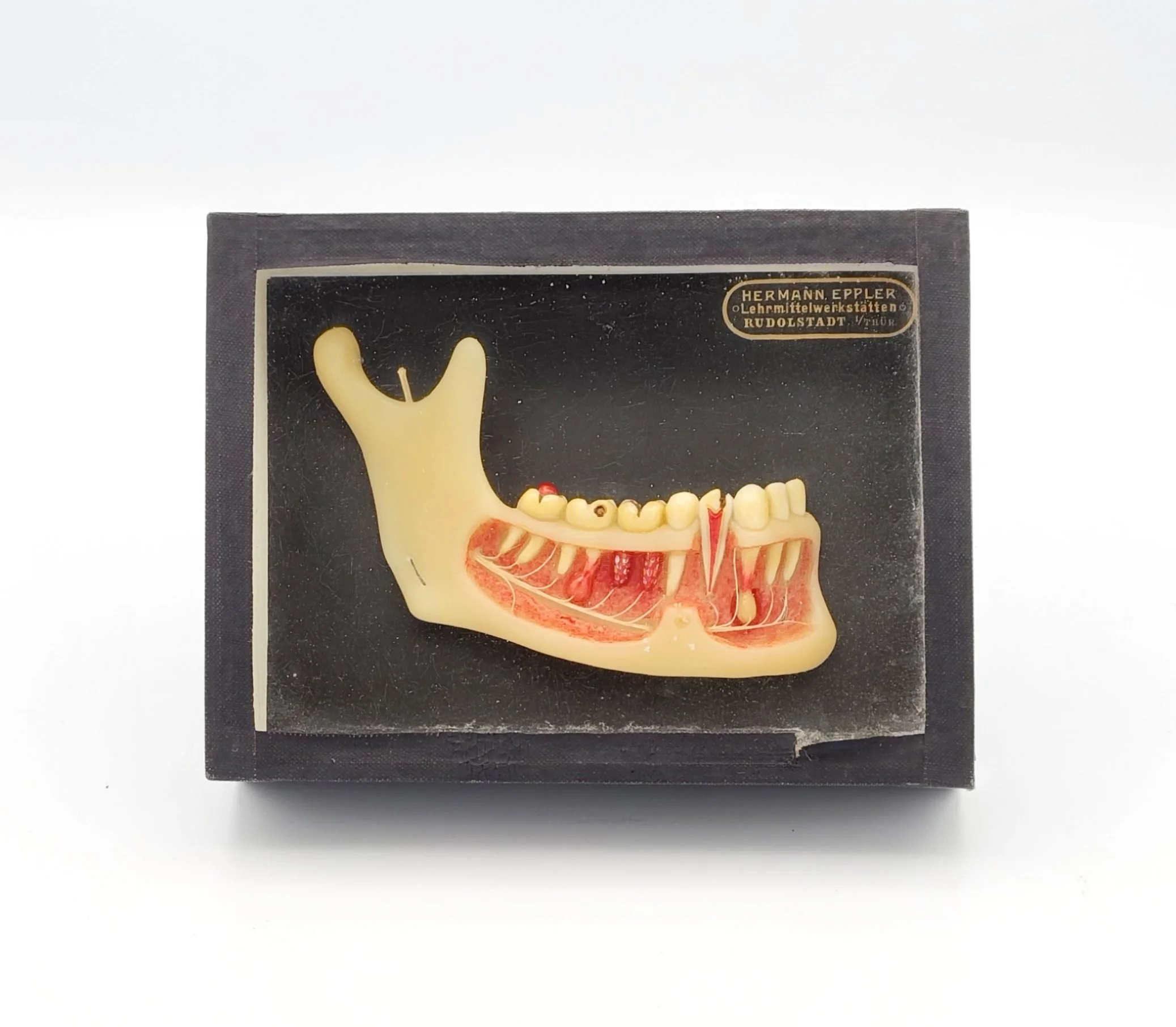 Wax model of the jaw by Hermann Eppler