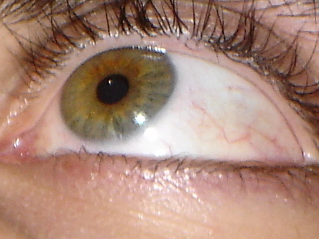My Eye.JPG