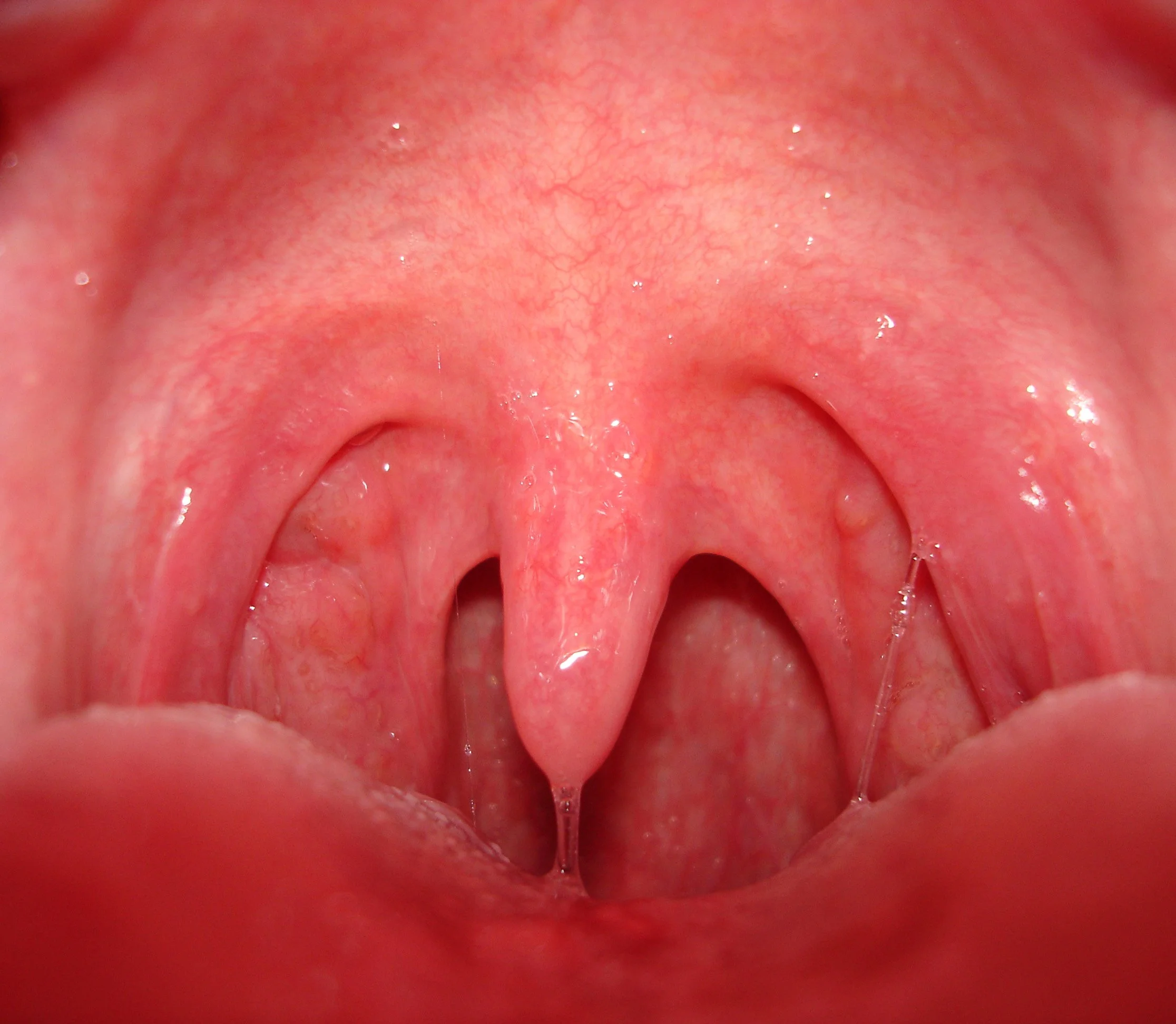 my mouth.jpg