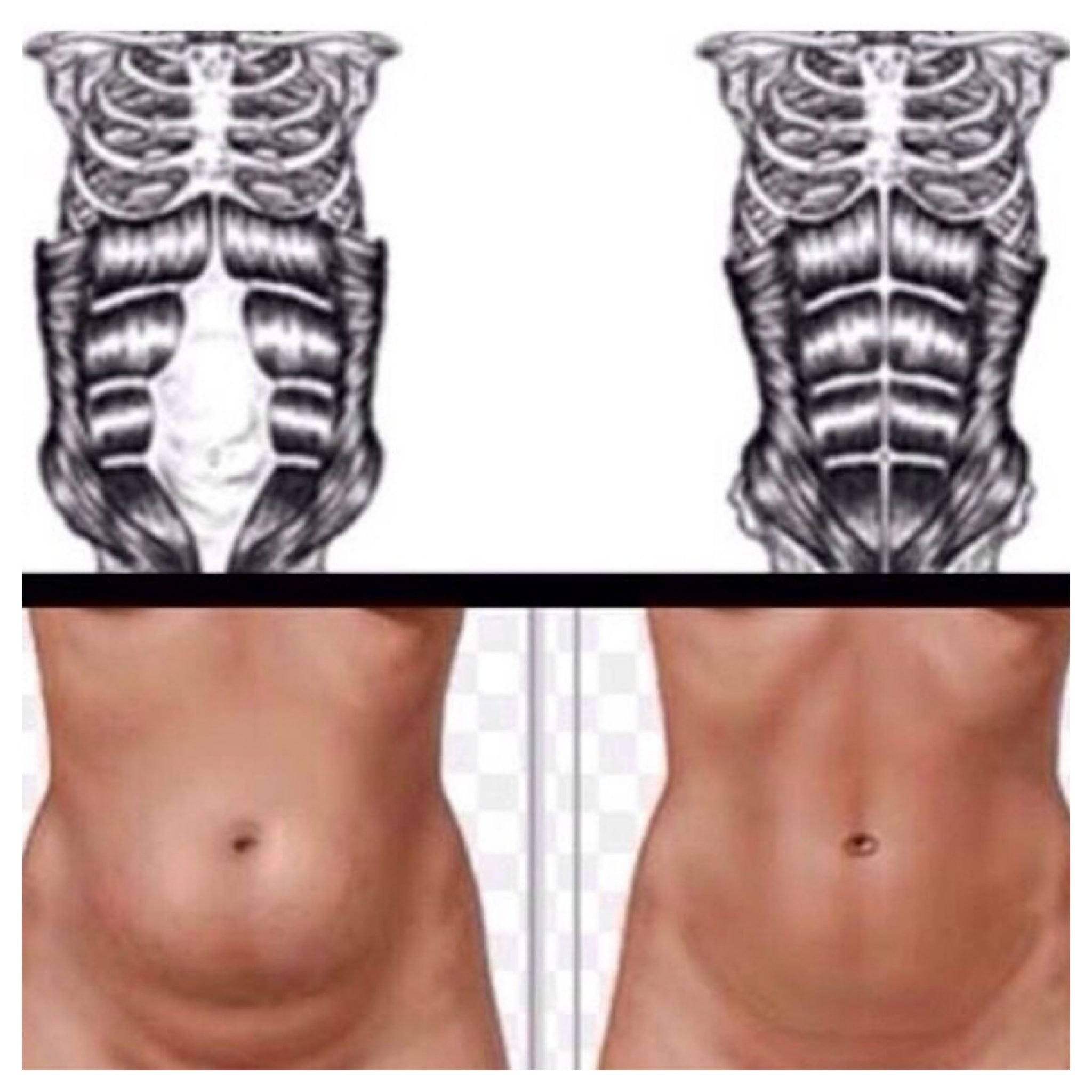 C sections Recovery and reducing the pouch CLAUDIA BEDFORD FITNESS