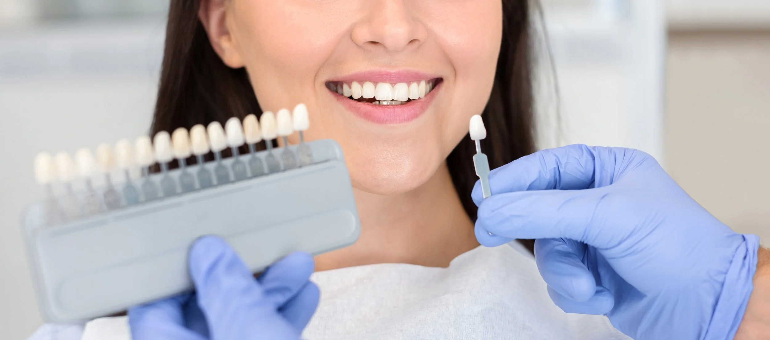close of up veneers and cosmetic dentistry in The Woodlands and Spring Tx show services available at WoodSprings Dentistry