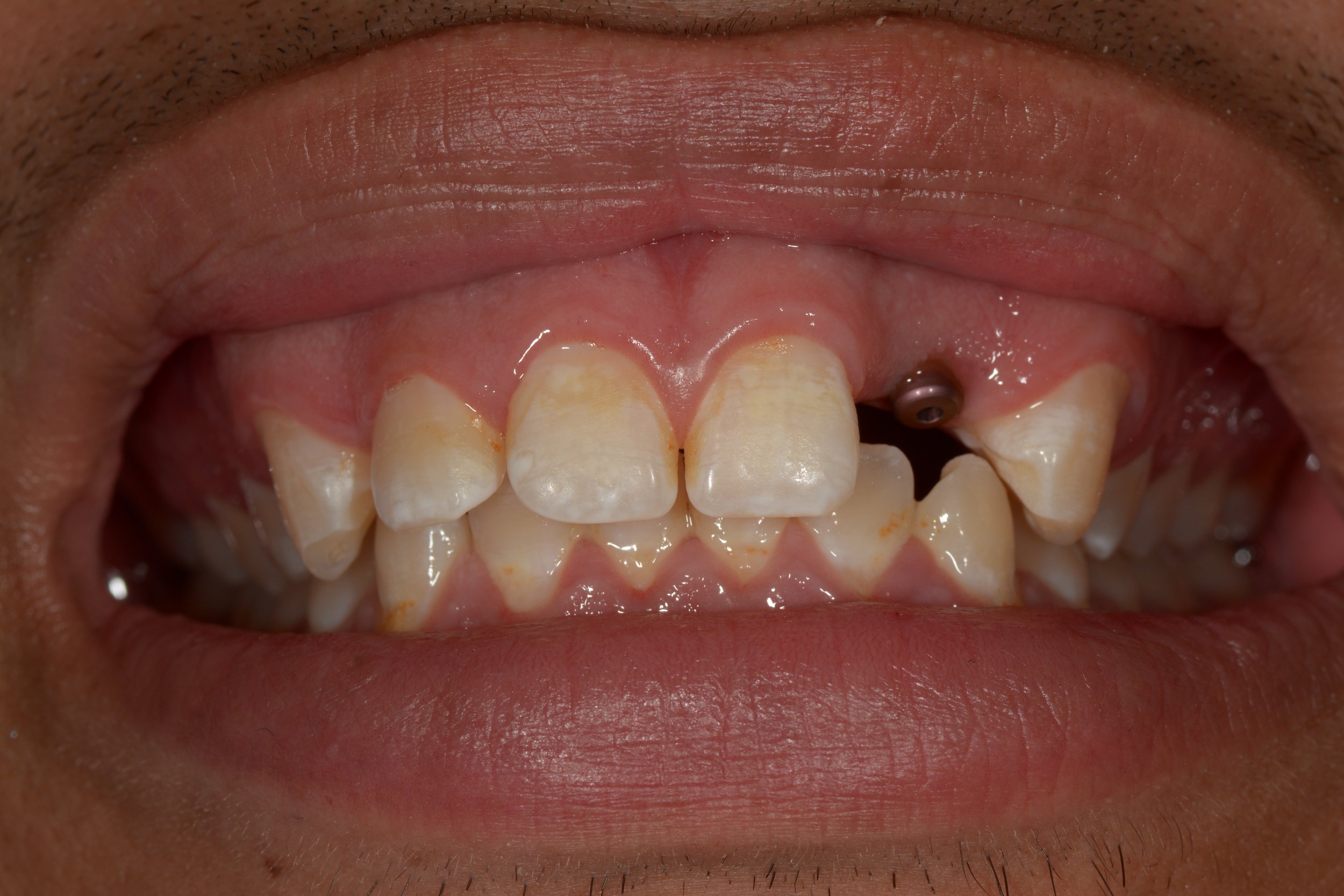 DSC_0570.JPG