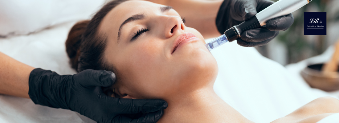 WHY YOU NEED SKIN NEEDLING