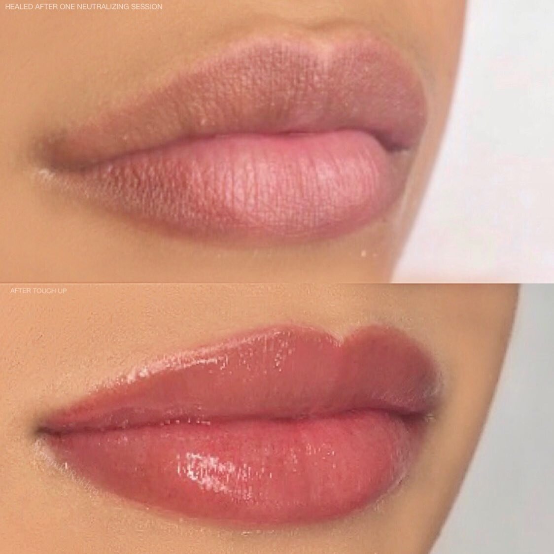 𝙃𝙀𝘼𝙇𝙀𝘿 results on top after first session of neutralizing. Bottom a splash of colour added 😍🌹
⁣
Neutralizing is a term we use to help cancel the coolness within ones lip tones. After we successfully complete that round we are able to add a fr