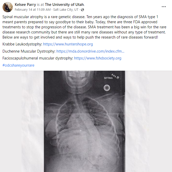 Kelsee Parry - University of Utah Hospital