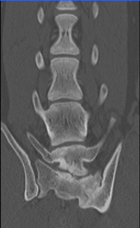 barkingbackblog-blogpost-body-Chelsea CT Scan 2.png