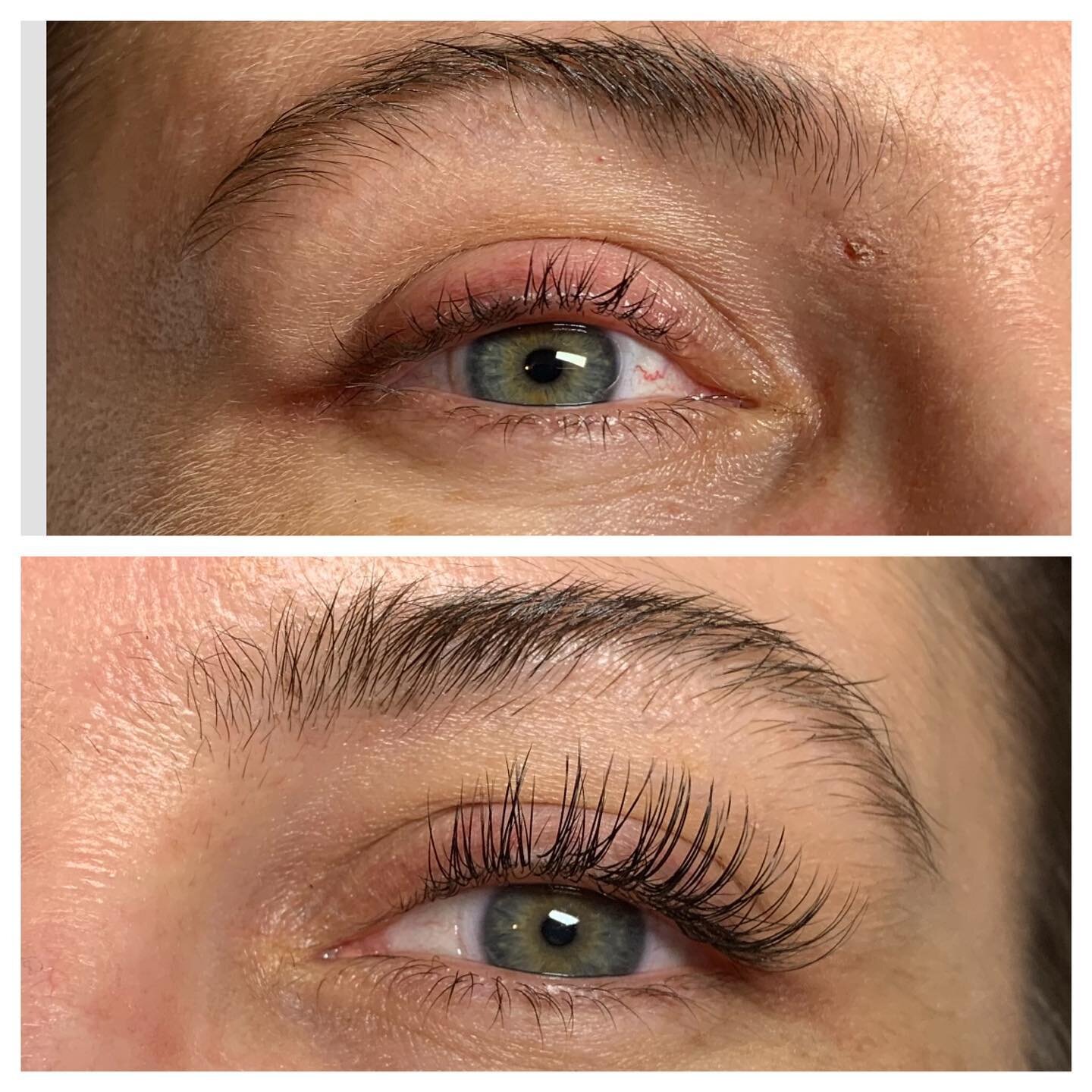 What a difference lashes make!Her eyes are bigger &amp; lashes frame her eye perfectly. 🙌🏼
&bull;
&bull;
&bull;
#beforeandafter #classiclash #lash #lashes #hybridlashes #3dlash #6dlashes #russianlashes #volume #dallastexas #salonlife #lashesonfleek