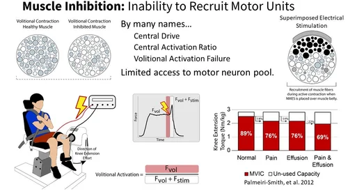Rewiring Recovery: Treating Muscle Inhibition After Knee Injury — LIVE4 ...