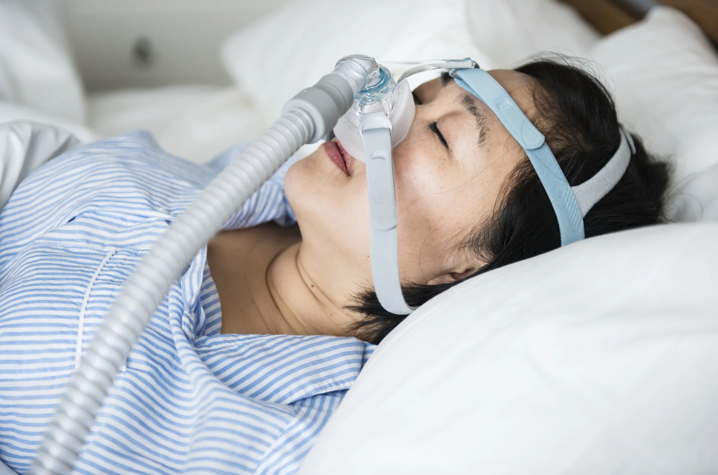 The Best Sleep Apnea Treatment Without CPAP — Better Breathing for Health