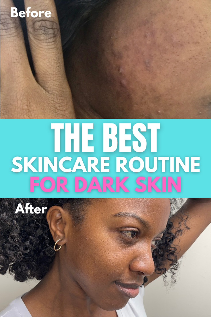 The Best Skincare Routine for Dark Skin