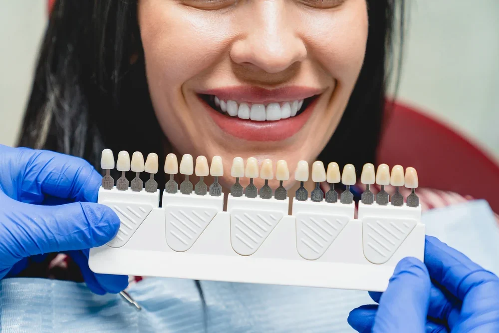 Dental professional displaying comprehensive shade palette for custom veneer color matching with smiling patient.