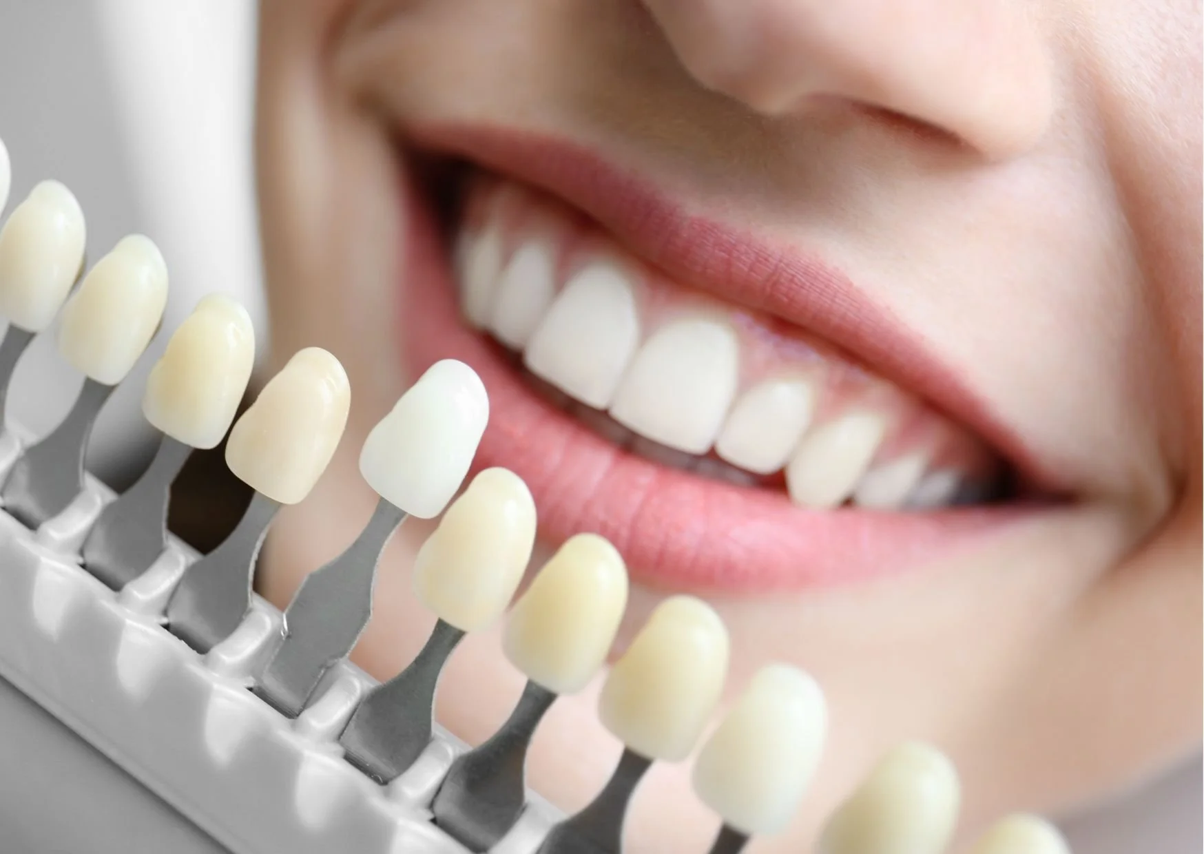 Teeth Whitening Boulder-SanitasDentistry.jpg