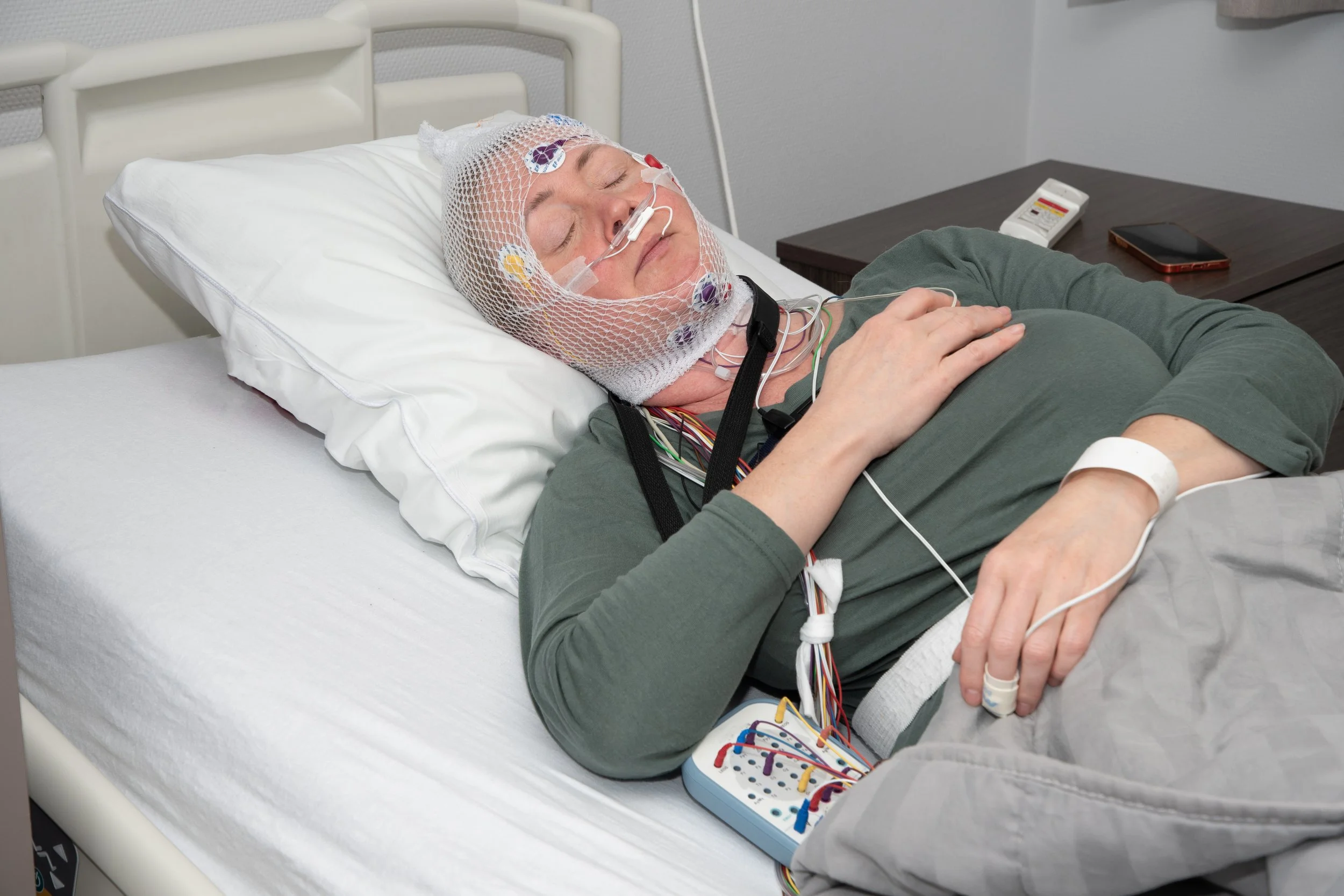 Patient lies in bed wearing monitoring equipment during an overnight sleep apnea evaluation.
