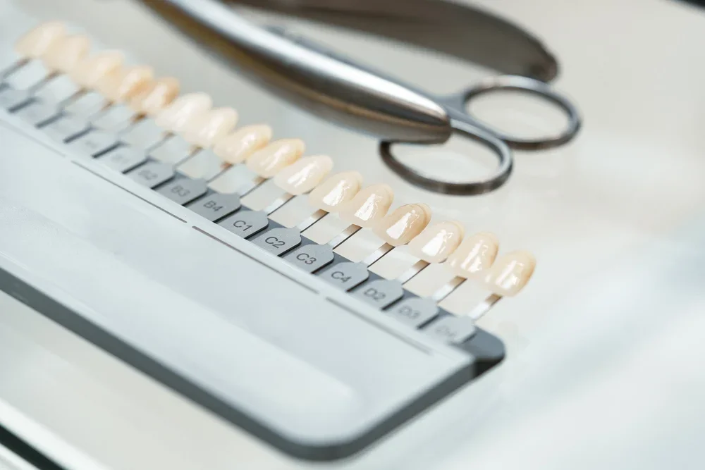 Dental shade guide with tools for matching veneer color to patient's natural teeth tone.