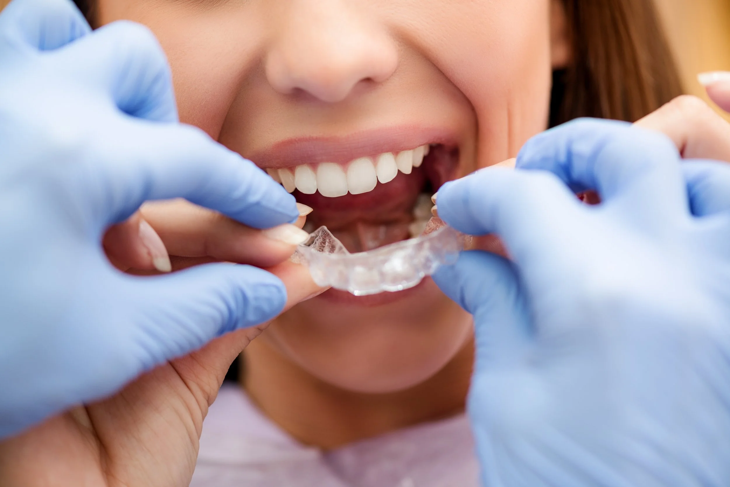 Smiling patient wearing protective eyewear holding clear aligner tray during dental consultation in Boulder clinic.