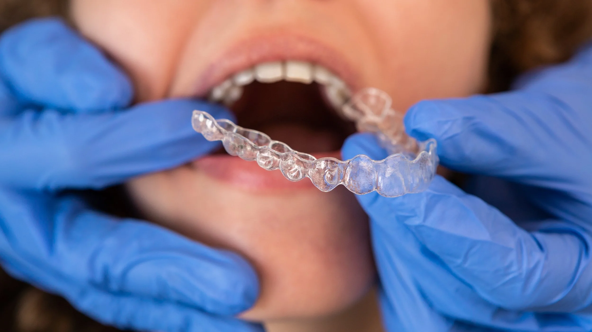 Dentist showing clear aligner tray and teeth model to smiling patient during orthodontic treatment explanation.